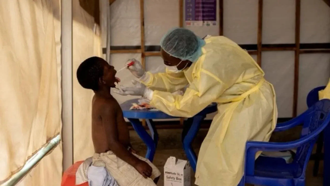 Nijerya’da “Lassa Ateşi”: 166 kişi yaşamını yitirdi