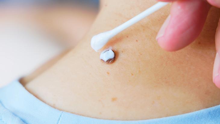 lazerle aldiran da var solusyon suren de her ben masum degil incelenmeli wAn5UzJ8.jpg