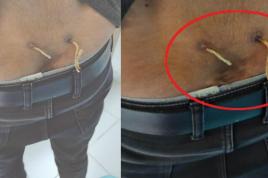 Alternatif Tıp | Independent Türkçe